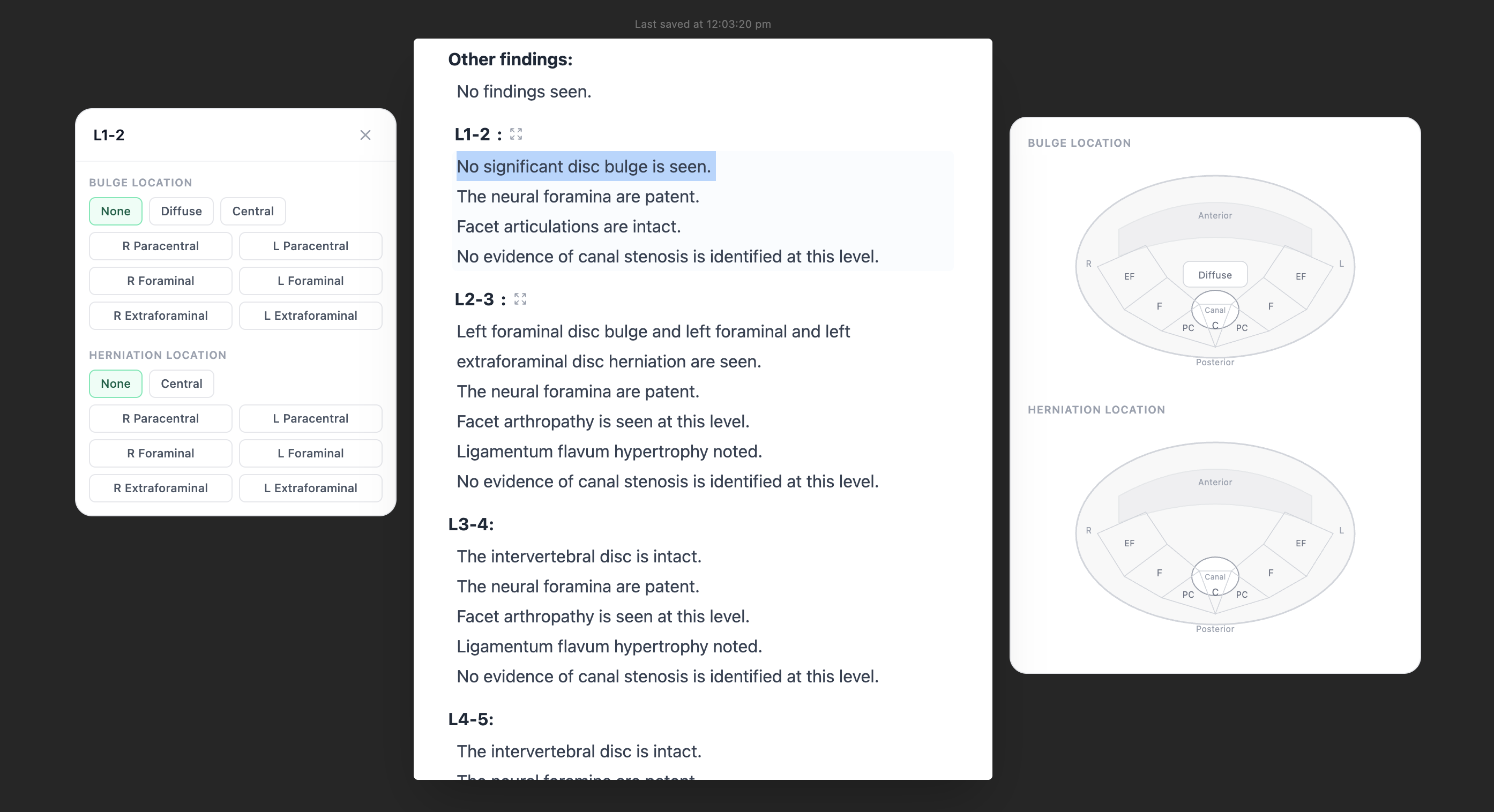 Skia click-based reporting interface